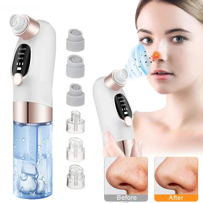 Removedor de espinillas, aspirador de poros, instrumento de limpieza multifuncional, máquina de limpieza facial con pequeñas burbujas, dispositivo de belleza