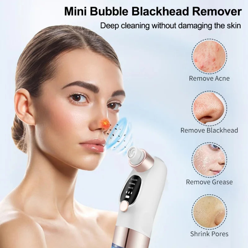Removedor de espinillas, aspirador de poros, instrumento de limpieza multifuncional, máquina de limpieza facial con pequeñas burbujas, dispositivo de belleza