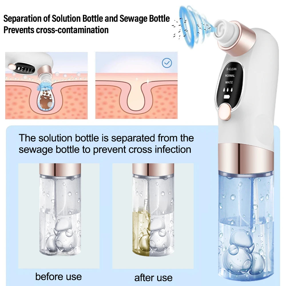 Removedor de espinillas, aspirador de poros, instrumento de limpieza multifuncional, máquina de limpieza facial con pequeñas burbujas, dispositivo de belleza