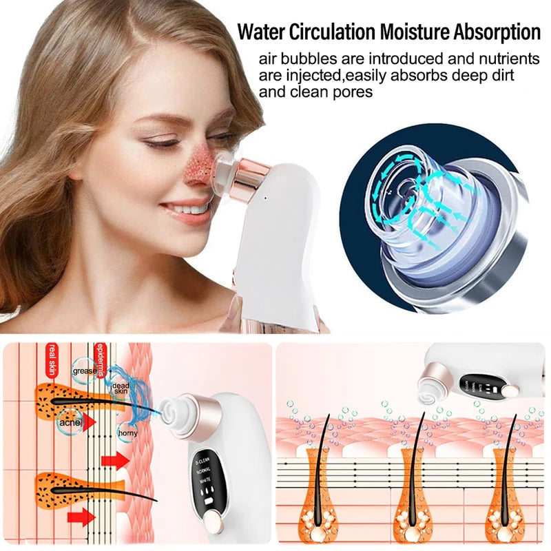 Removedor de espinillas, aspirador de poros, instrumento de limpieza multifuncional, máquina de limpieza facial con pequeñas burbujas, dispositivo de belleza