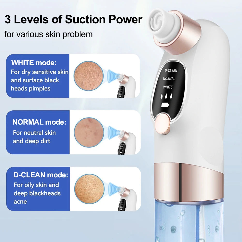 Removedor de espinillas, aspirador de poros, instrumento de limpieza multifuncional, máquina de limpieza facial con pequeñas burbujas, dispositivo de belleza