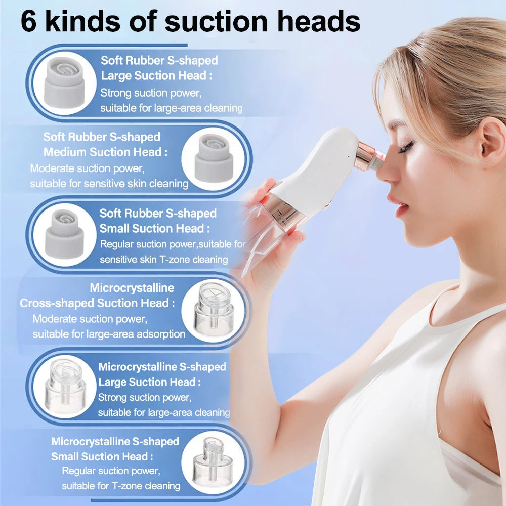 Removedor de espinillas, aspirador de poros, instrumento de limpieza multifuncional, máquina de limpieza facial con pequeñas burbujas, dispositivo de belleza