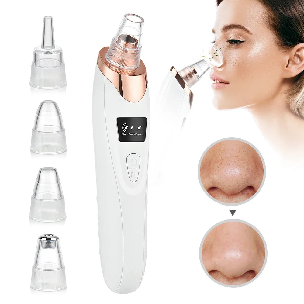 Removedor eléctrico de espinillas, limpiador al vacío para acné, eliminación de manchas negras, limpieza Facial profunda de poros, máquina limpiadora de poros, herramientas para el cuidado de la piel