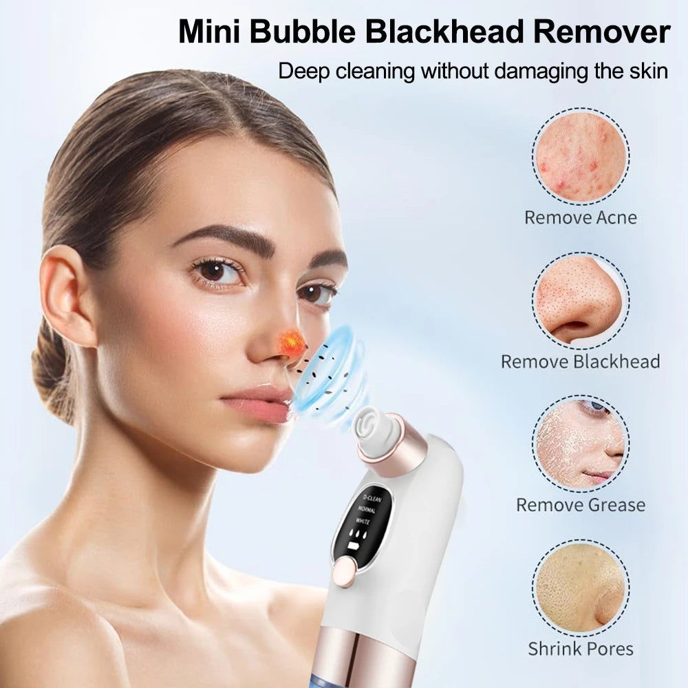 Removedor de espinillas, aspirador de poros, instrumento de limpieza multifuncional, máquina de limpieza facial con pequeñas burbujas, dispositivo de belleza