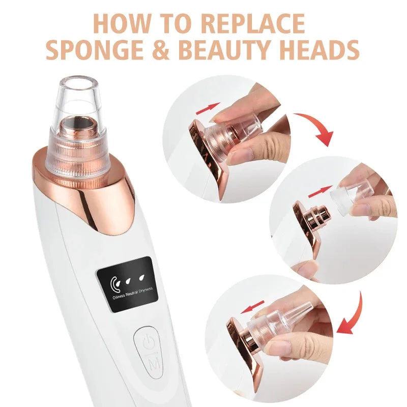 Removedor eléctrico de espinillas, limpiador al vacío para acné, eliminación de manchas negras, limpieza Facial profunda de poros, máquina limpiadora de poros, herramientas para el cuidado de la piel
